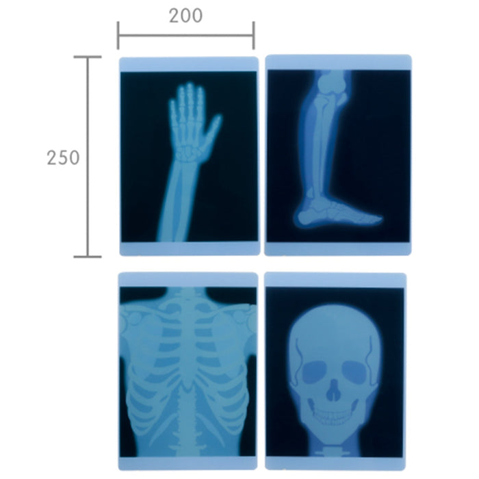 X-Ray Film 4 Piece Set