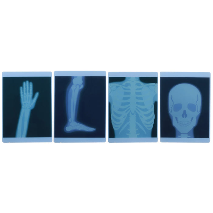 X-Ray Film 4 Piece Set